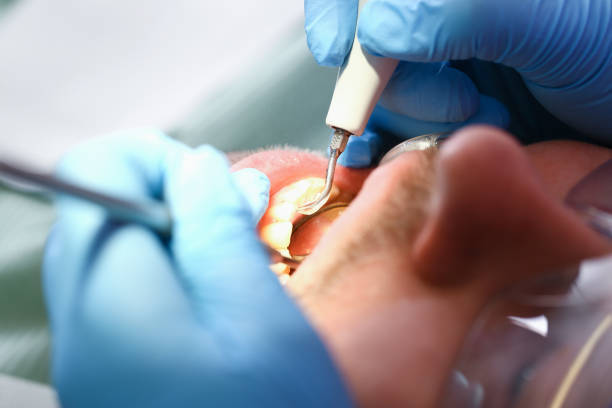 Best Cracked Tooth Emergency Dentist  in Chadds Ford, PA