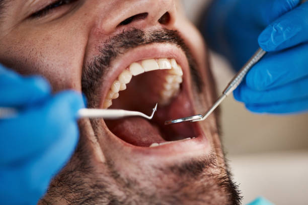 Best Knocked-Out Tooth Emergency  in Chadds Ford, PA