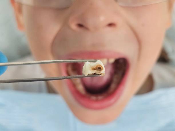 Best Cracked Tooth Emergency Dentist  in Chadds Ford, PA